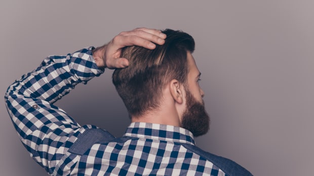 The Five Benefits of a Hair Transplant