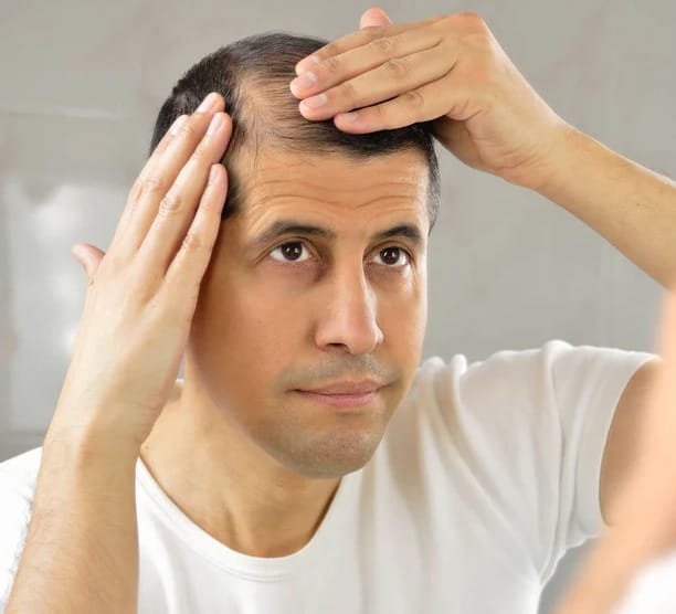 How Hair Loss Starts