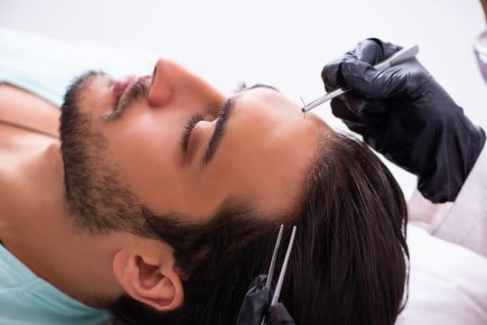 Plan For Hair Transplant