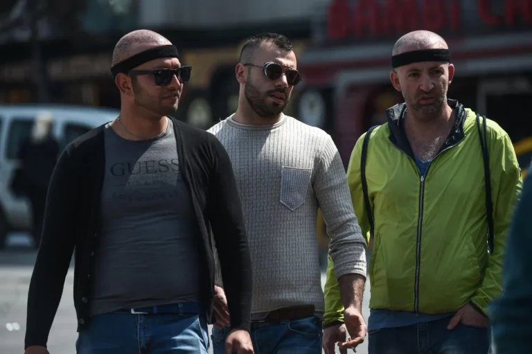 Hair Transplant Tourism