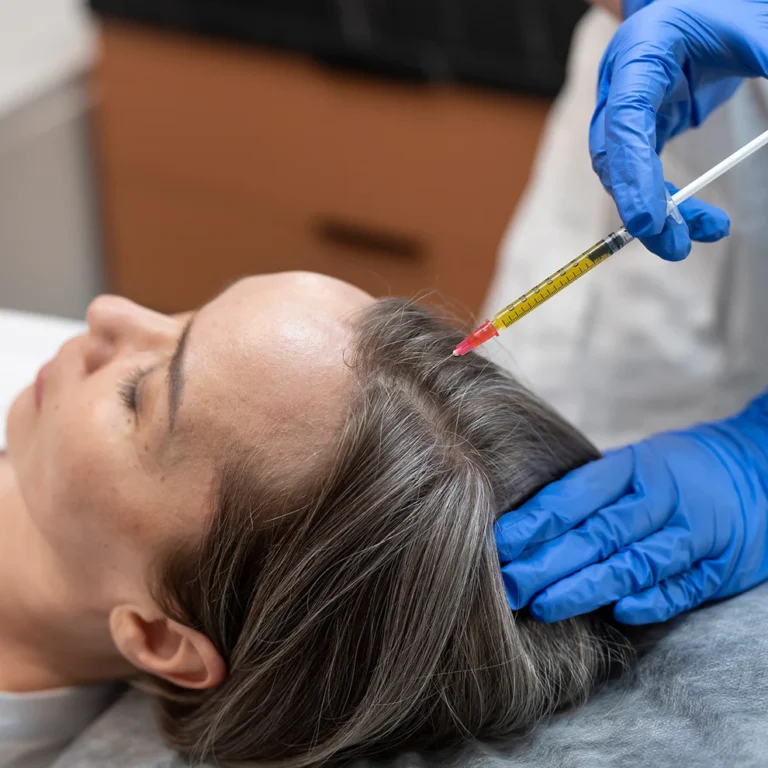 PRP and Hair Restoration