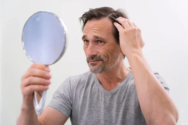 5 Signs It’s Time to Take Action For Your Hair Loss